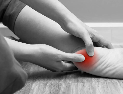 The Fastest Cure For Plantar Fasciitis
